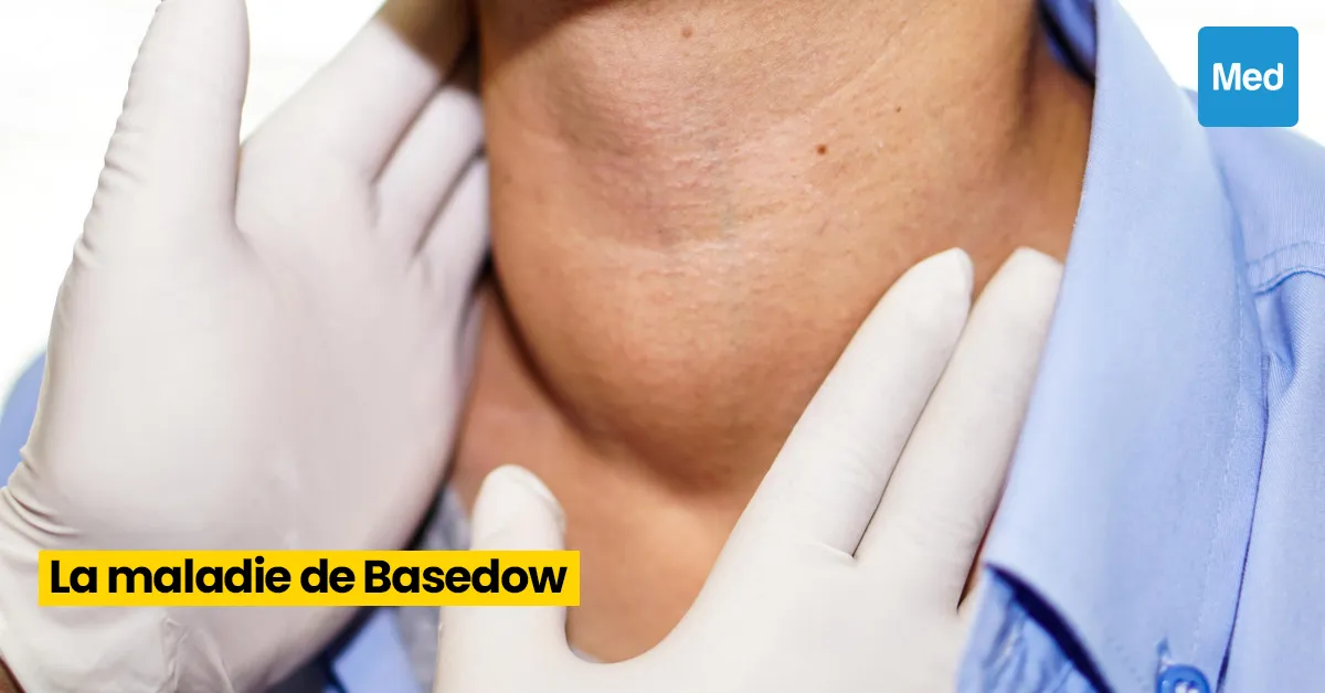 La Maladie de Basedow : Comprendre, Gérer, Vivre